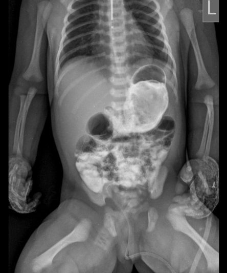 2 Abdomen