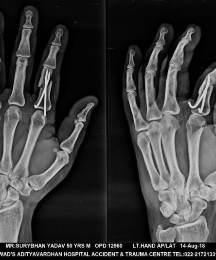 27 Hand