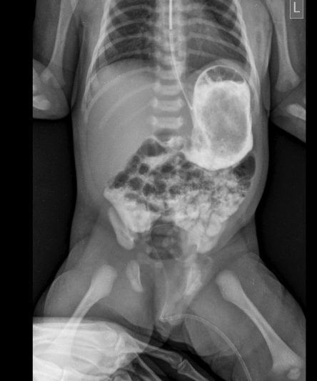 3 Abdomen