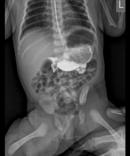 4 Abdomen