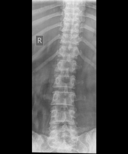 49 -Lumbar