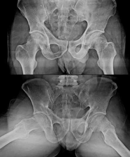 5 Pelvis