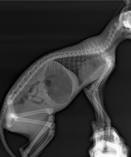 Gas in stomach and c1 fracture