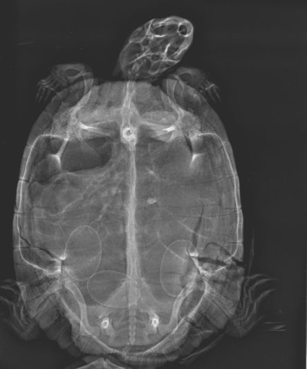 Turtle Shell Fracture